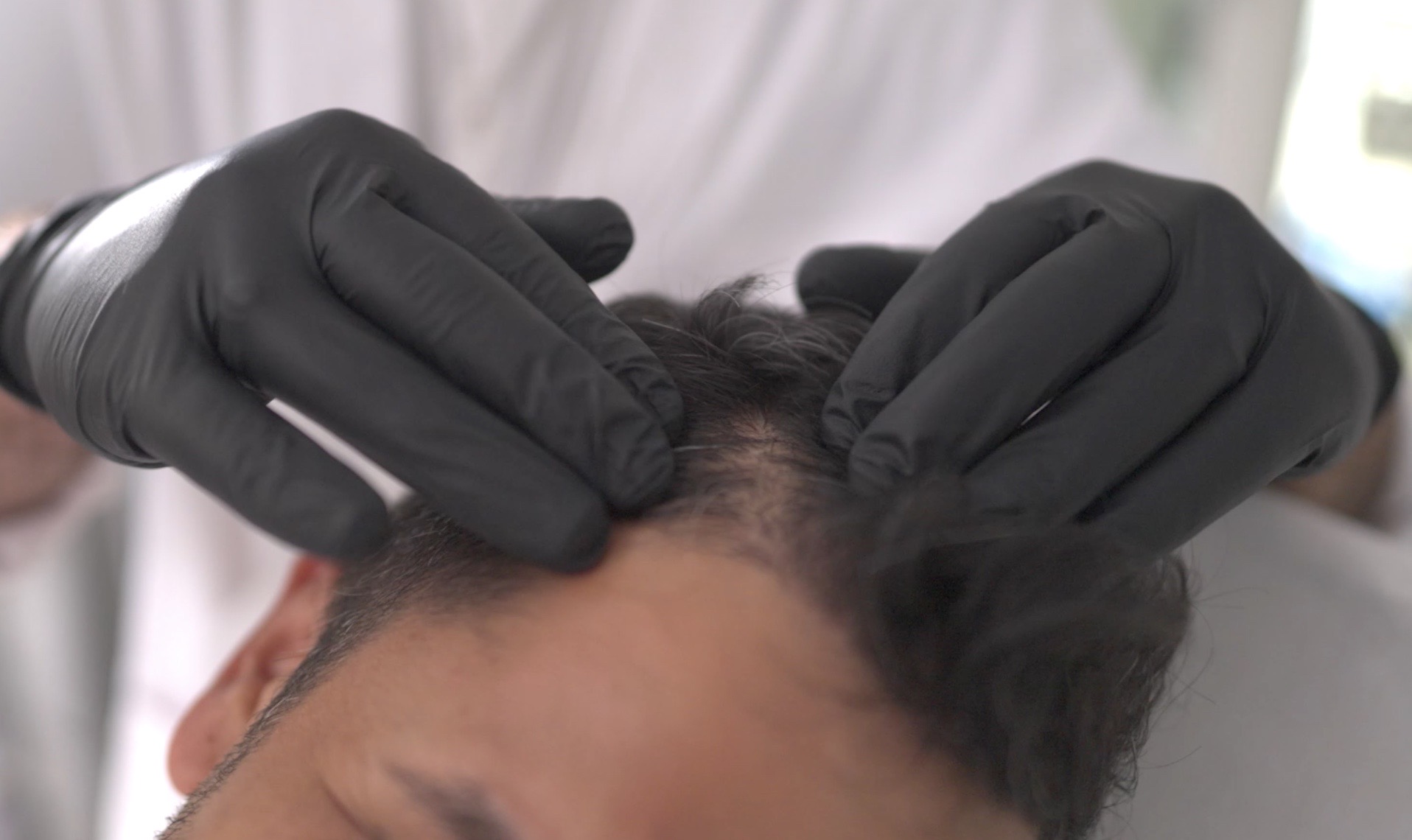 טיפולים לחיזוק השיער